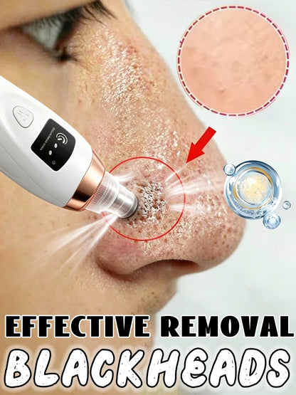 Blackhead Remover Pore Vacuum, Electric Suction Tool for Nose &amp; Face