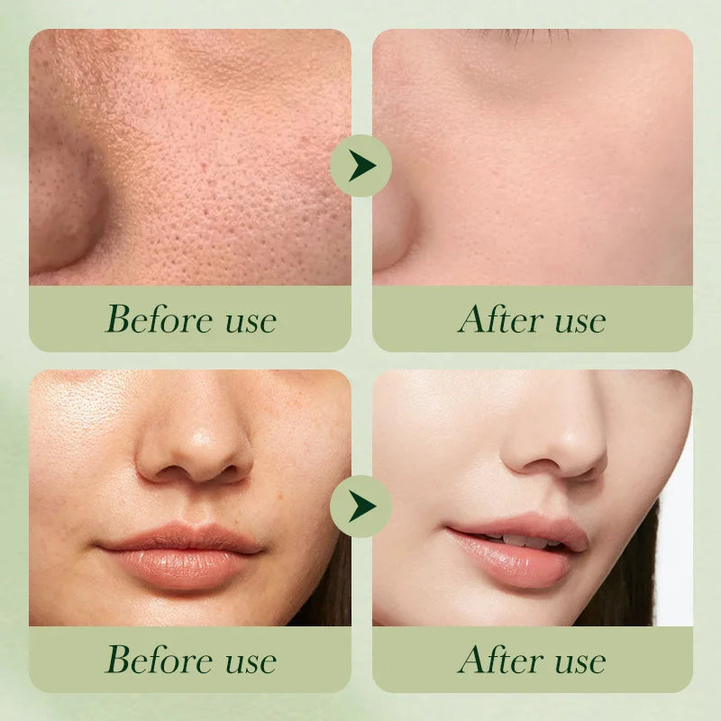 Avocado Anti-Wrinkle Skincare Set, 6-Piece Face &amp; Eye Cream Kit