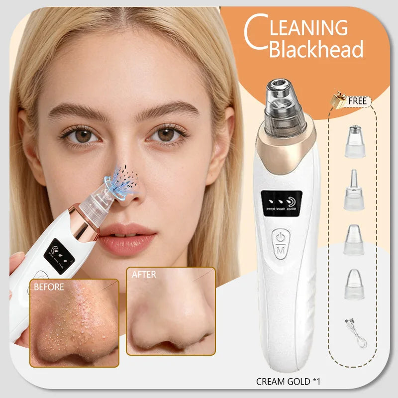 Blackhead Remover Pore Vacuum, Electric Suction Tool for Nose &amp; Face