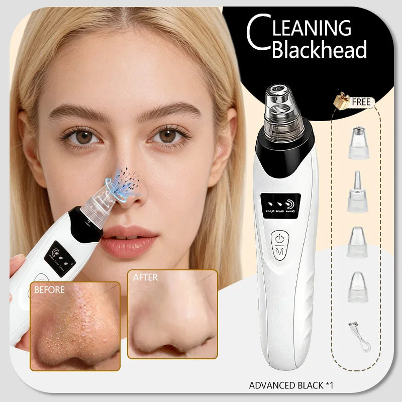 Blackhead Remover Pore Vacuum, Electric Suction Tool for Nose &amp; Face