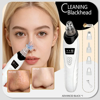 Blackhead Remover Pore Vacuum, Electric Suction Tool for Nose &amp; Face