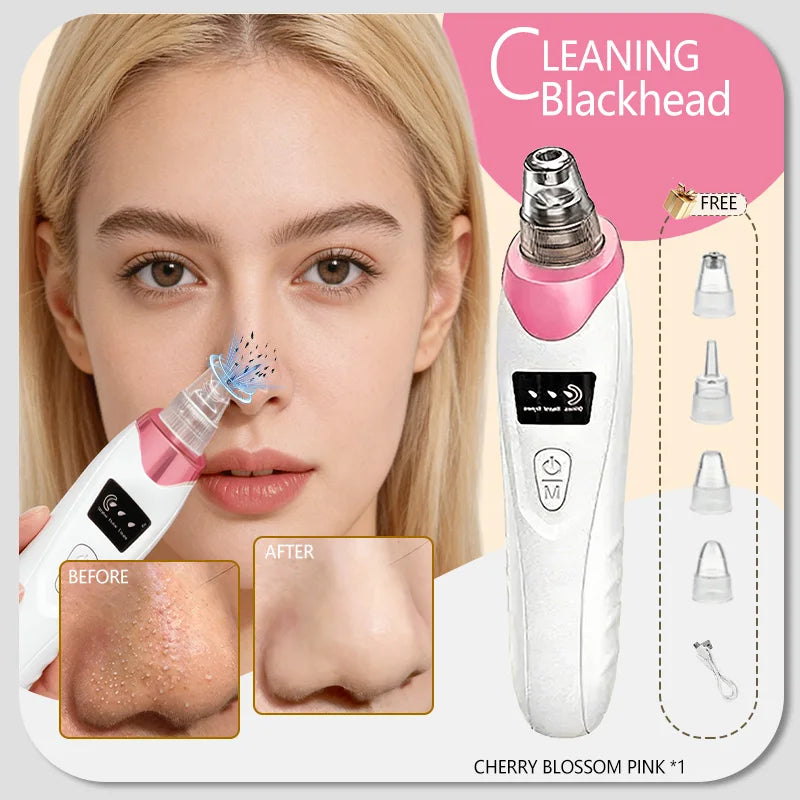 Blackhead Remover Pore Vacuum, Electric Suction Tool for Nose &amp; Face