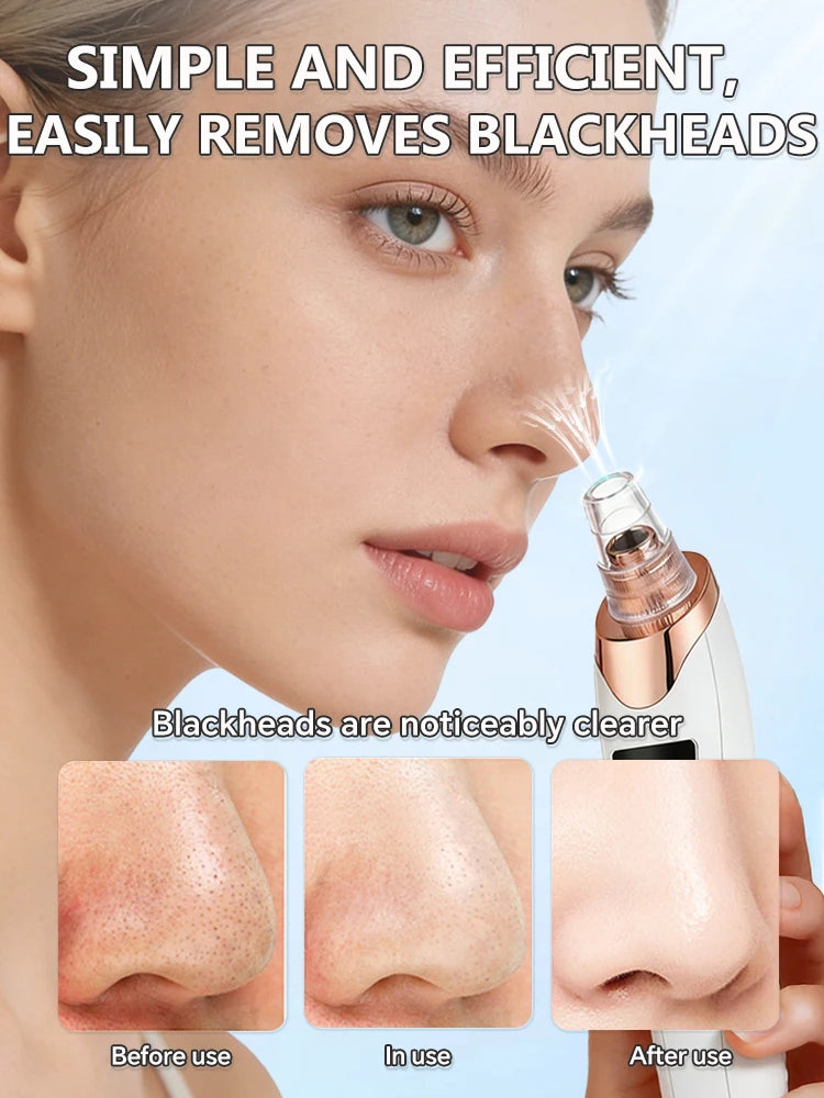 Blackhead Remover Pore Vacuum, Electric Suction Tool for Nose & Face