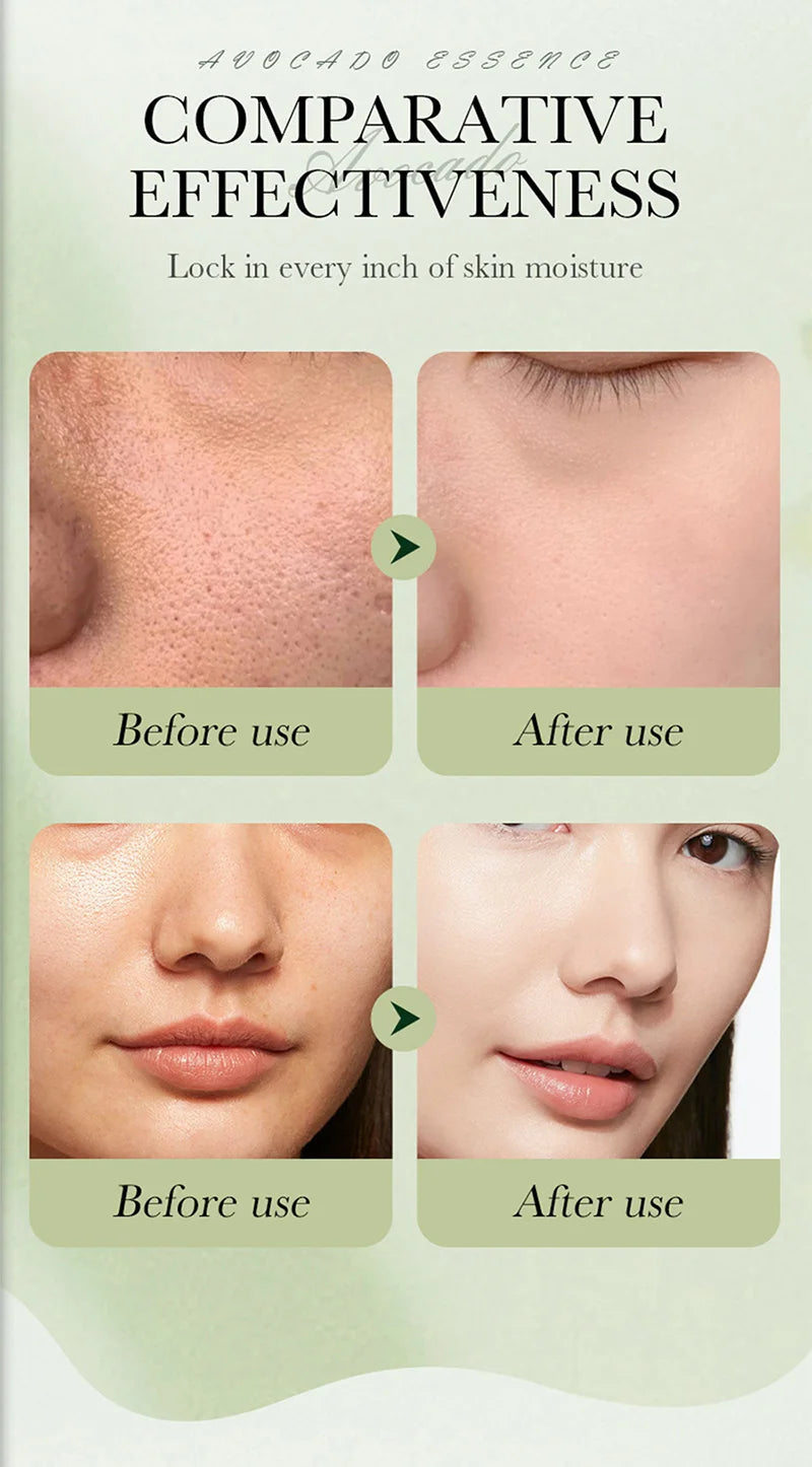Avocado Anti-Wrinkle Skincare Set, 6-Piece Face & Eye Cream Kit
