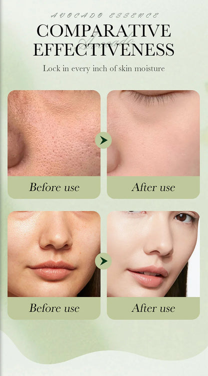 Avocado Anti-Wrinkle Skincare Set, 6-Piece Face &amp; Eye Cream Kit