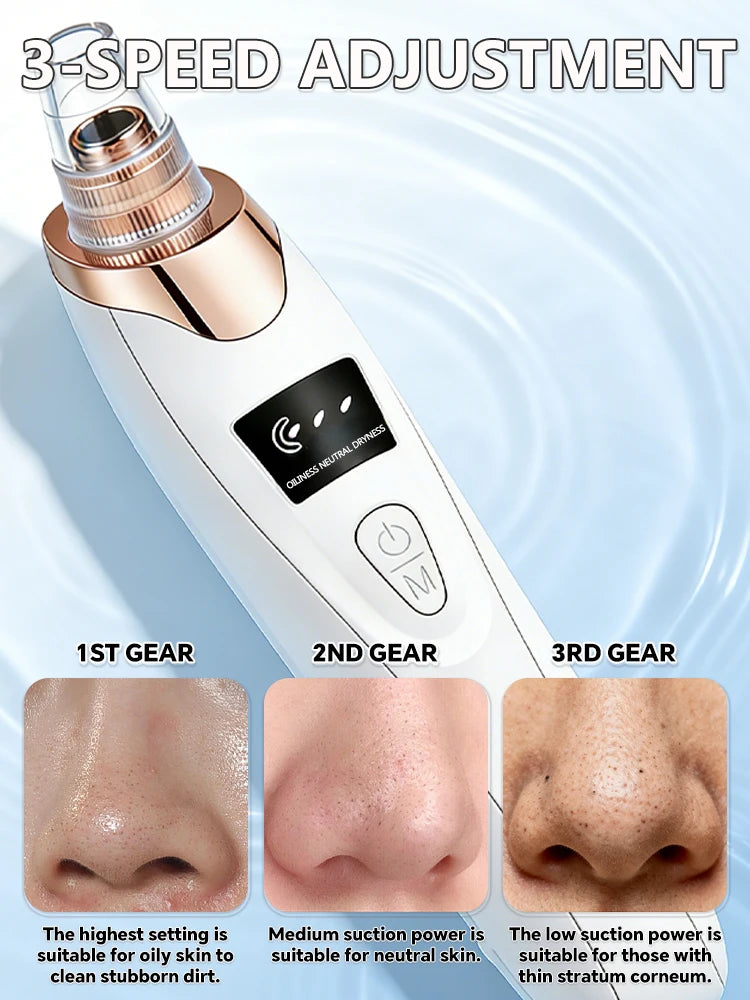 Blackhead Remover Pore Vacuum, Electric Suction Tool for Nose &amp; Face
