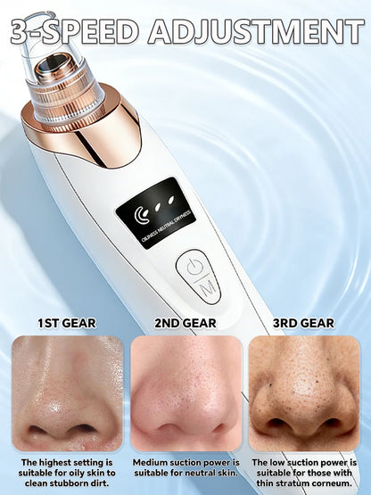 Blackhead Remover Pore Vacuum, Electric Suction Tool for Nose &amp; Face