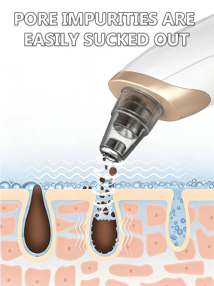 Blackhead Remover Pore Vacuum, Electric Suction Tool for Nose & Face